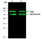 CPNE1 Antibody in Immunoprecipitation (IP)