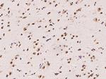 CPSF2 Antibody in Immunohistochemistry (Paraffin) (IHC (P))