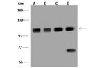 CPSF2 Antibody in Western Blot (WB)