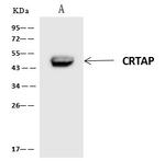 CRTAP Antibody in Immunoprecipitation (IP)