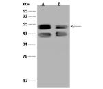 CRTAP Antibody in Western Blot (WB)