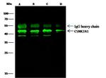 CK2 alpha-1 Antibody in Immunoprecipitation (IP)