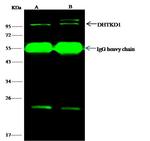 DHTKD1 Antibody in Immunoprecipitation (IP)