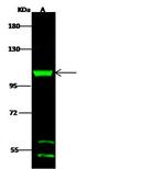 DHTKD1 Antibody in Western Blot (WB)