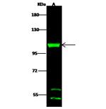 DHTKD1 Antibody in Western Blot (WB)