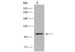 Dynamin 1 Antibody in Western Blot (WB)