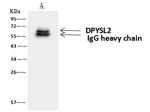 CRMP2 Antibody in Immunoprecipitation (IP)