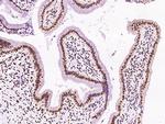 DR1 Antibody in Immunohistochemistry (Paraffin) (IHC (P))