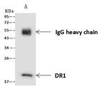 DR1 Antibody in Immunoprecipitation (IP)