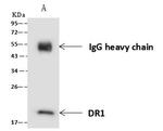 DR1 Antibody in Immunoprecipitation (IP)