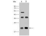 DR1 Antibody in Western Blot (WB)