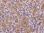 DTYMK Antibody in Immunohistochemistry (Paraffin) (IHC (P))