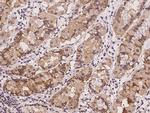 DTYMK Antibody in Immunohistochemistry (Paraffin) (IHC (P))