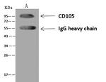 CD105 Antibody in Immunoprecipitation (IP)