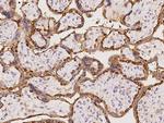 EPS8L2 Antibody in Immunohistochemistry (Paraffin) (IHC (P))