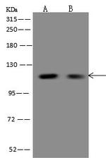 FBF1 Antibody in Western Blot (WB)