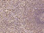 G6PD Antibody in Immunohistochemistry (Paraffin) (IHC (P))