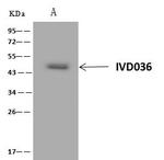 GFAP Antibody in Immunoprecipitation (IP)