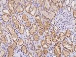 GPT2 Antibody in Immunohistochemistry (Paraffin) (IHC (P))