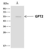 GPT2 Antibody in Immunoprecipitation (IP)