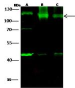 HK1 Antibody in Western Blot (WB)