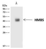 HMBS Antibody in Immunoprecipitation (IP)