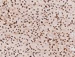 hnRNP C Antibody in Immunohistochemistry (Paraffin) (IHC (P))