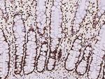 hnRNP C Antibody in Immunohistochemistry (Paraffin) (IHC (P))