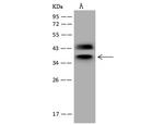 hnRNP C Antibody in Western Blot (WB)