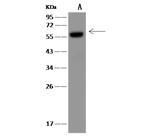 IMPDH2 Antibody in Western Blot (WB)