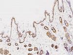 KRT14 Antibody in Immunohistochemistry (Paraffin) (IHC (P))