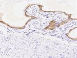 KRT14 Antibody in Immunohistochemistry (Paraffin) (IHC (P))