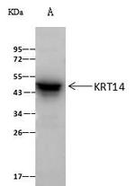 KRT14 Antibody in Immunoprecipitation (IP)