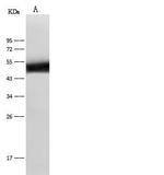 KRT14 Antibody in Western Blot (WB)