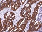 Cytokeratin 18 Antibody in Immunohistochemistry (Paraffin) (IHC (P))