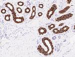 Cytokeratin 18 Antibody in Immunohistochemistry (Paraffin) (IHC (P))