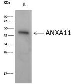 Cytokeratin 18 Antibody in Immunoprecipitation (IP)