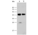 Cytokeratin 18 Antibody in Western Blot (WB)