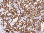 Cytokeratin 18 Antibody in Immunohistochemistry (Paraffin) (IHC (P))