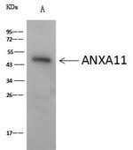 Cytokeratin 18 Antibody in Immunoprecipitation (IP)