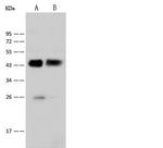 Cytokeratin 18 Antibody in Western Blot (WB)