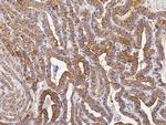 Cytokeratin 19 Antibody in Immunohistochemistry (Paraffin) (IHC (P))