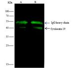 Cytokeratin 19 Antibody in Immunoprecipitation (IP)