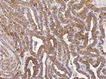 Cytokeratin 19 Antibody in Immunohistochemistry (Paraffin) (IHC (P))