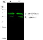 Cytokeratin 19 Antibody in Immunoprecipitation (IP)