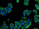 Cytokeratin 8 Antibody in Immunocytochemistry (ICC/IF)