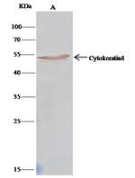 Cytokeratin 8 Antibody in Immunoprecipitation (IP)