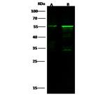 Cytokeratin 8 Antibody in Western Blot (WB)