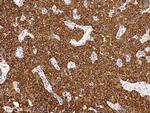 Cytokeratin 8 Antibody in Immunohistochemistry (Paraffin) (IHC (P))