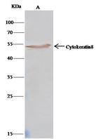 Cytokeratin 8 Antibody in Immunoprecipitation (IP)